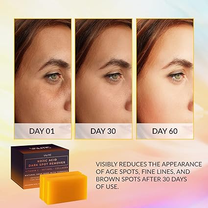 VALITIC Kojic Acid Dark Spot Remover Soap Bars with Vitamin C, Retinol, Collagen, Turmeric - Original Japanese Complex Infused with Hyaluronic Acid, Vitamin E, Shea Butter, Castile Olive Oil (2 Pack) : Beauty & Personal Care